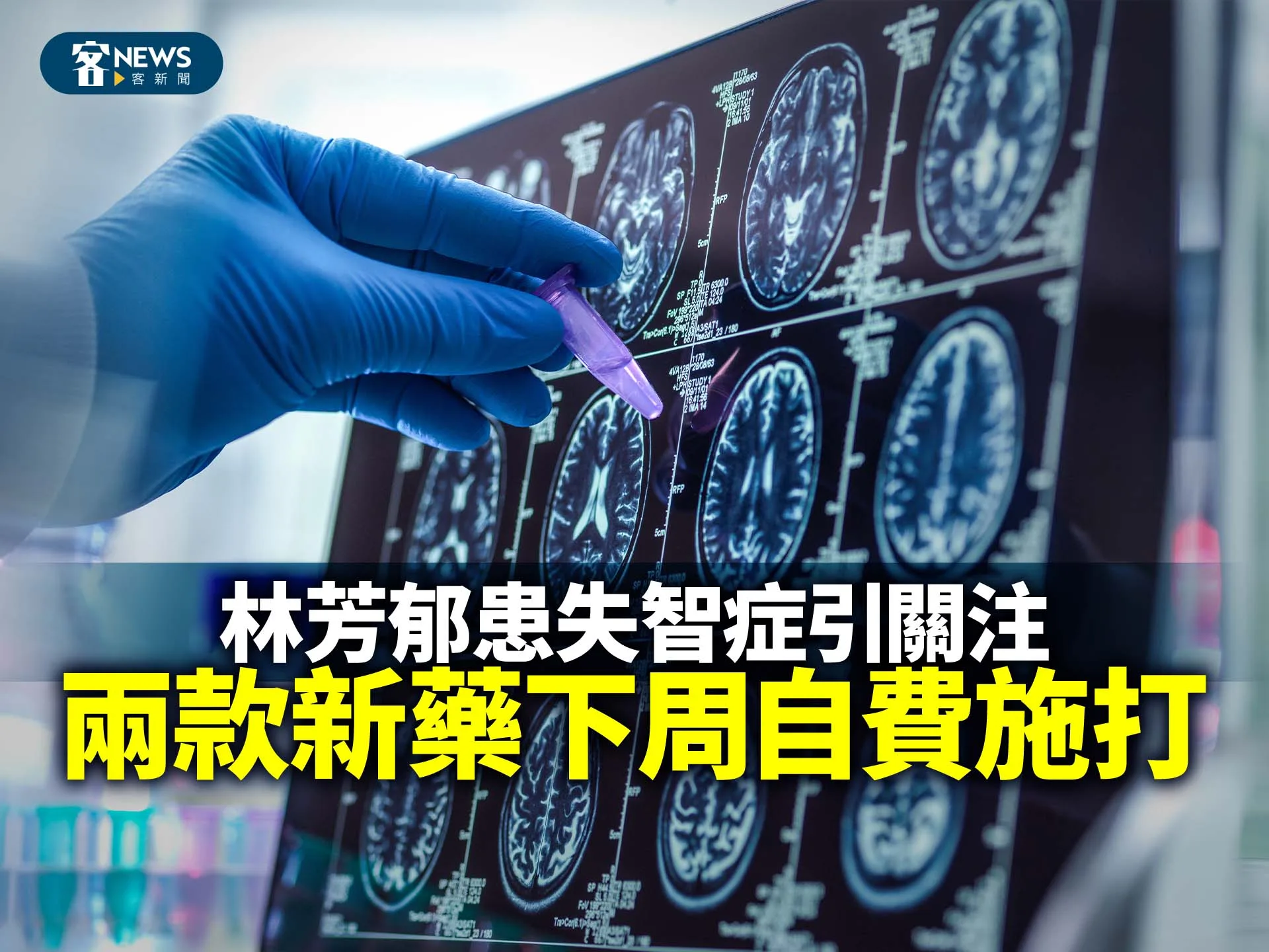 林芳郁患失智症引關注　兩款新藥下周自費施打's story cover image