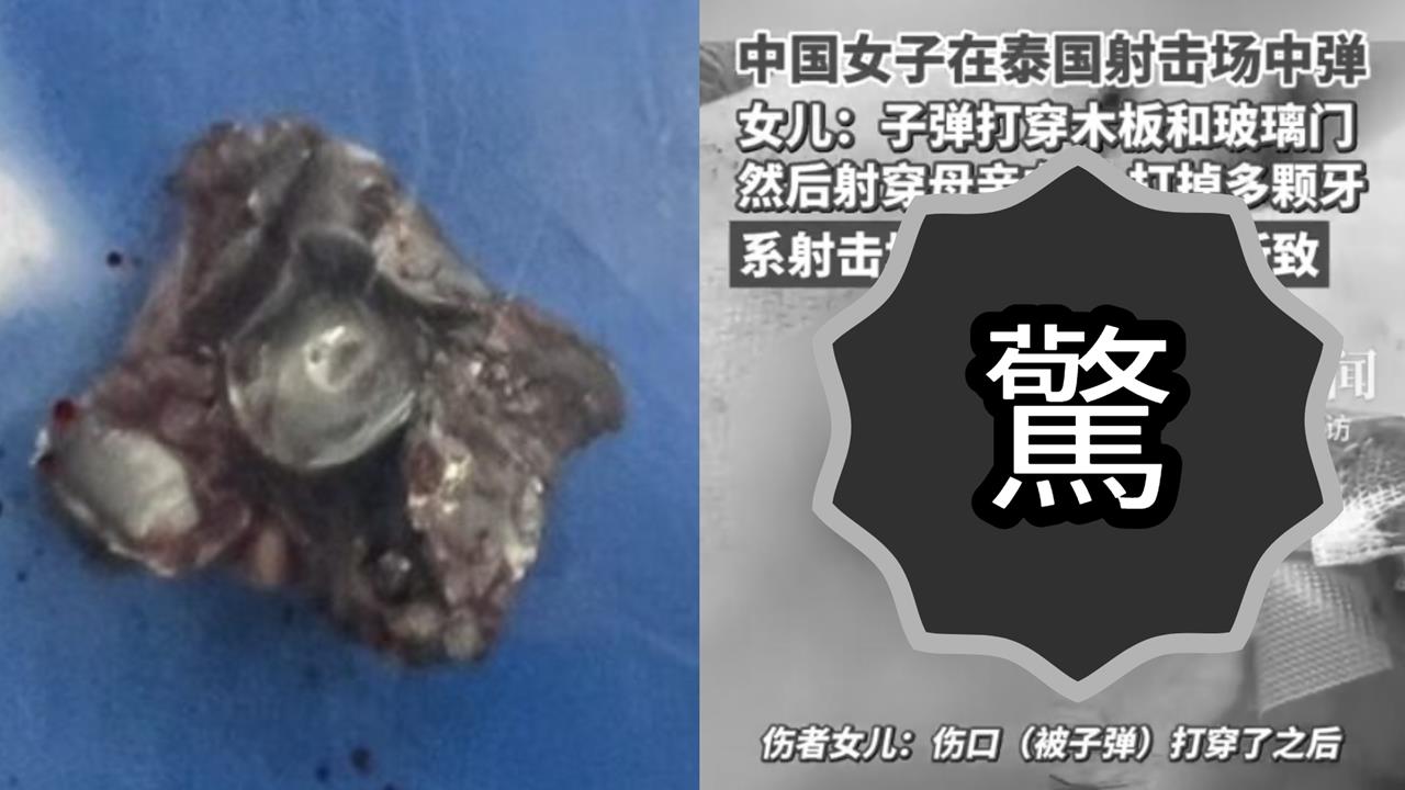 中國女遊客遭子彈穿臉！「留黑洞」驚悚傷勢曝光