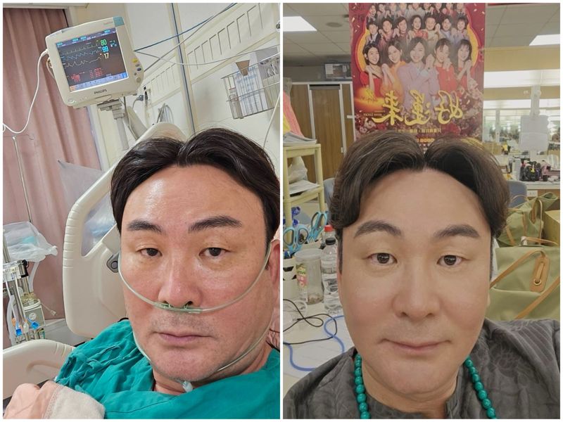 八點檔男星驚傳爆肝緊急入加護　一度病危昏迷5天's story cover image