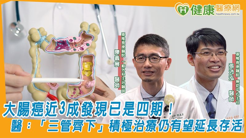 大腸癌近3成發現已是四期！醫：「三管齊下」積極治療仍有望延長存活's story cover image