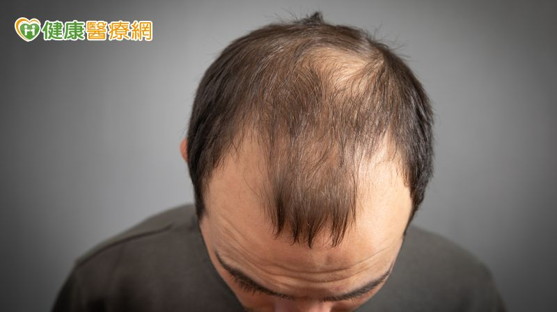 禿頭族新福音？台大研發「含天然脂肪酸」生髮精華　20天促小鼠毛髮再生's story cover image