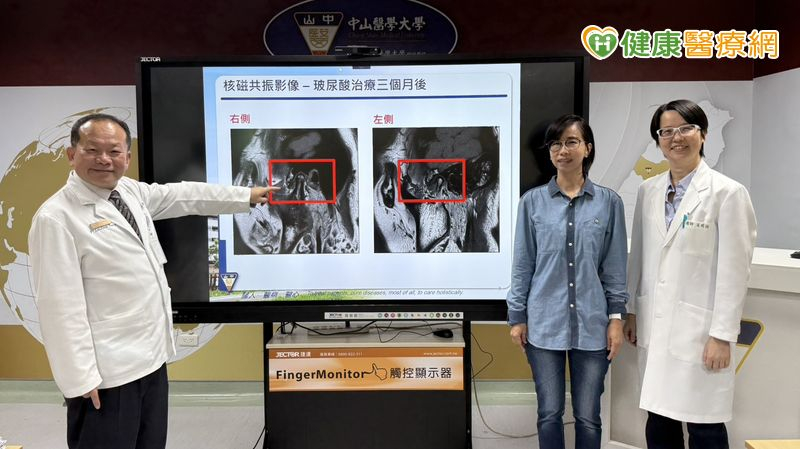 總不自覺咬牙也釀頭痛、肩頸痛？醫：當心「顳顎關節障礙症候群」上身's story cover image