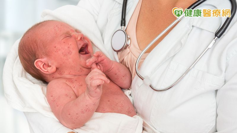 「怎麼抱」攸關寶寶髖關節發育是否正常　醫籲：六個月是治療黃金期's story cover image