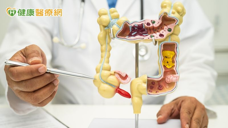 腸癌「TNT治療」保留肛門！適用癌友多's story cover image
